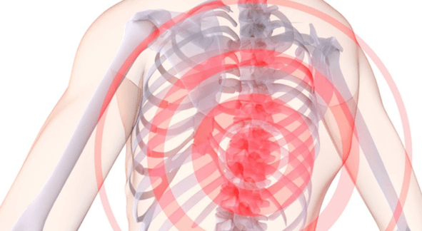 Dolore alla colonna vertebrale con osteocondrosi toracica